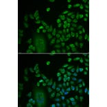 Immunofluorescence - Anti-LSM4 Antibody (A88309) - Antibodies.com