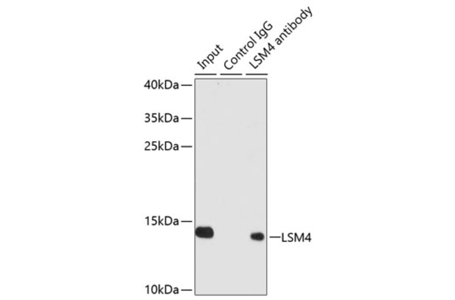 Western Blot - Anti-LSM4 Antibody (A88309) - Antibodies.com
