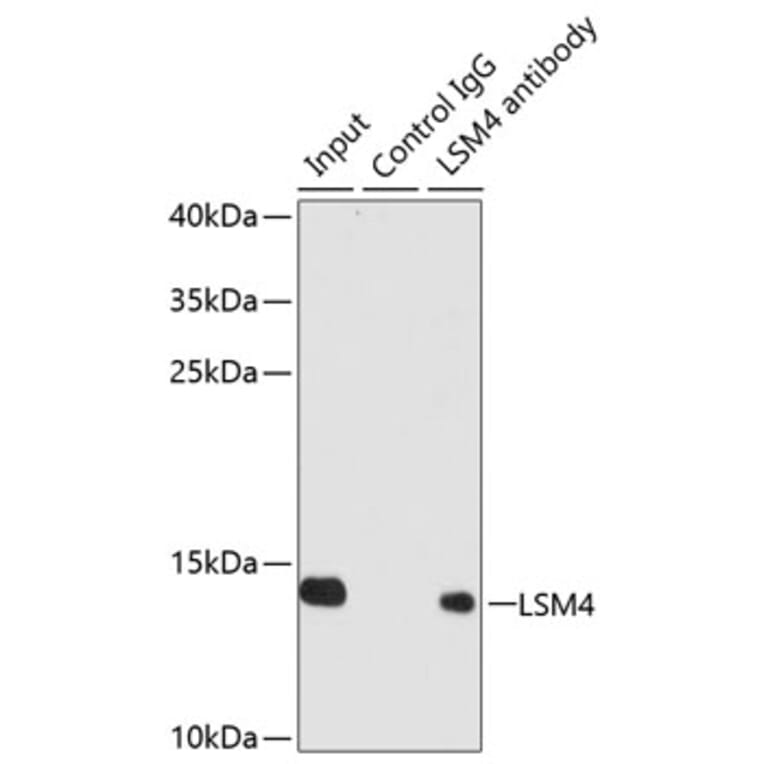 Western Blot - Anti-LSM4 Antibody (A88309) - Antibodies.com