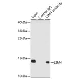 Western Blot - Anti-LSM4 Antibody (A88309) - Antibodies.com