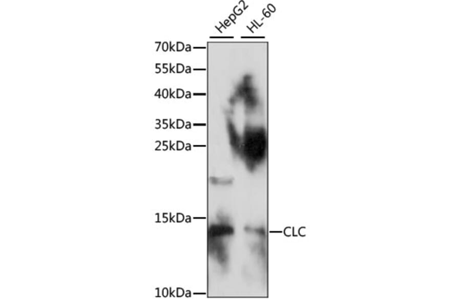 Western Blot - Anti-Galectin 10 Antibody (A88310) - Antibodies.com
