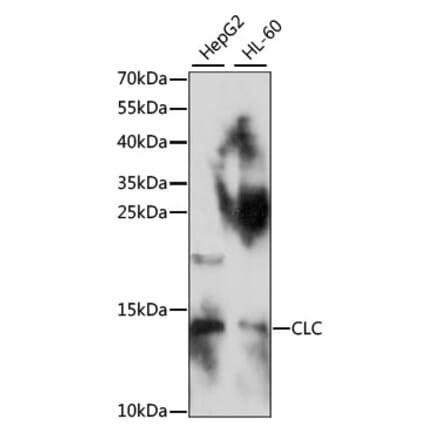 Western Blot - Anti-Galectin 10 Antibody (A88310) - Antibodies.com