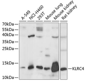 Western Blot - Anti-KLRC4 Antibody (A88311) - Antibodies.com