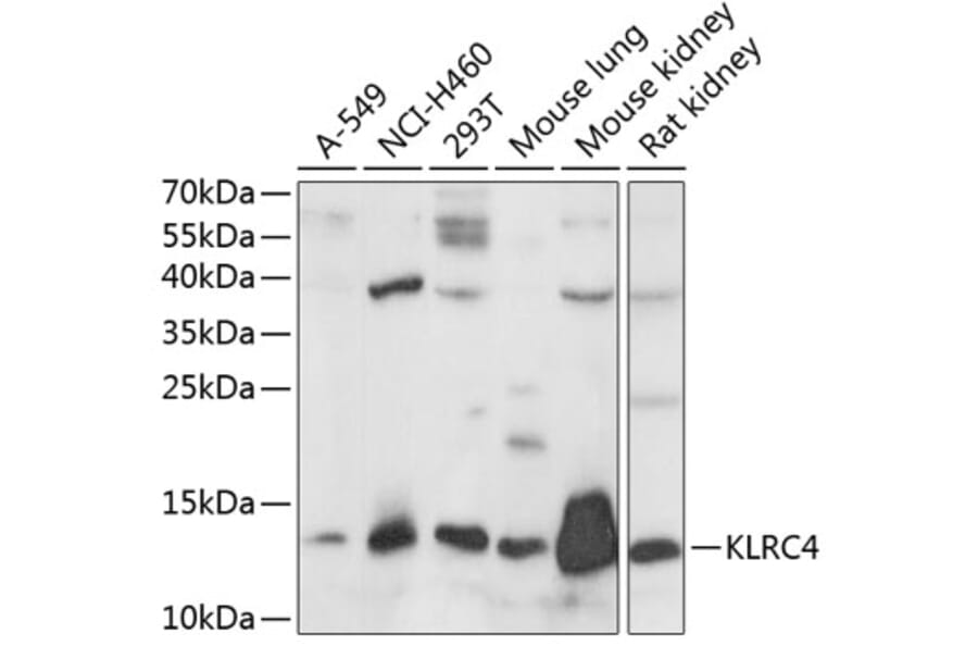 Western Blot - Anti-KLRC4 Antibody (A88311) - Antibodies.com