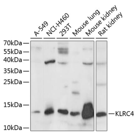 Western Blot - Anti-KLRC4 Antibody (A88311) - Antibodies.com