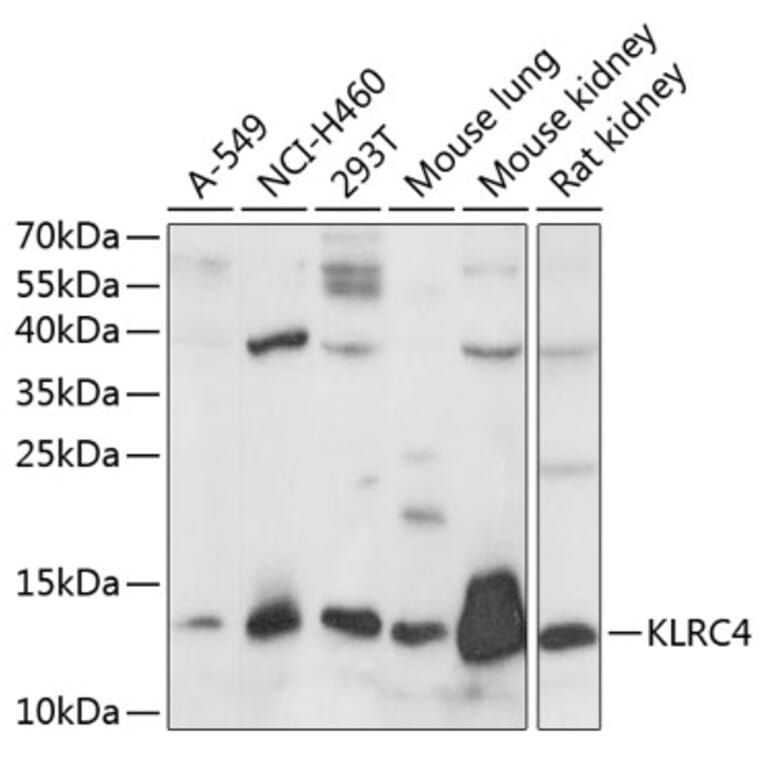 Western Blot - Anti-KLRC4 Antibody (A88311) - Antibodies.com
