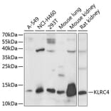 Western Blot - Anti-KLRC4 Antibody (A88311) - Antibodies.com