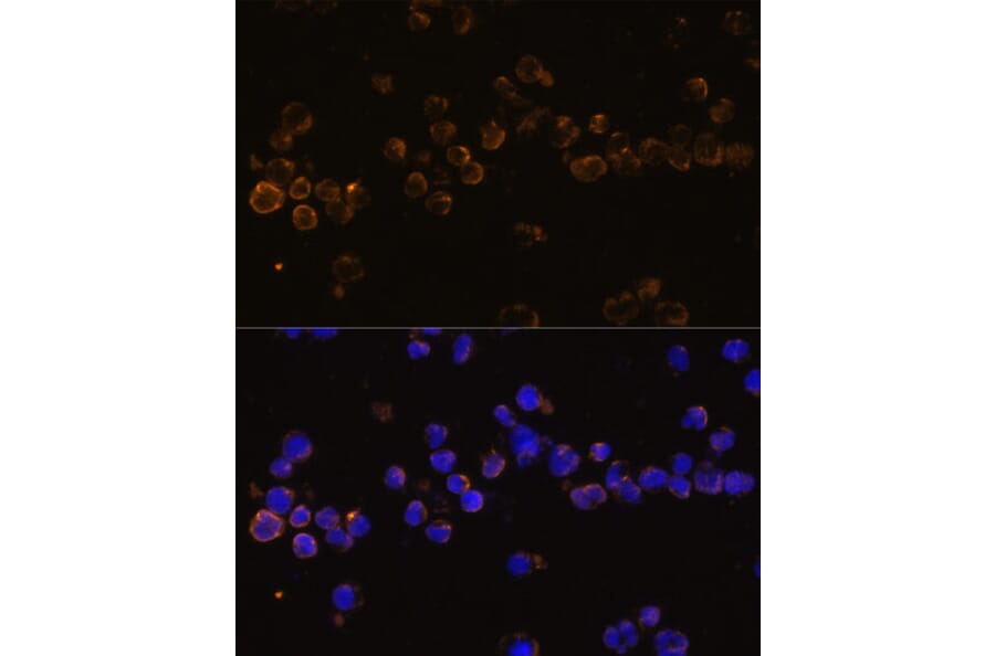Immunofluorescence - Anti-KLRC4 Antibody (A88311) - Antibodies.com