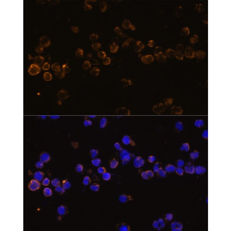 Immunofluorescence - Anti-KLRC4 Antibody (A88311) - Antibodies.com