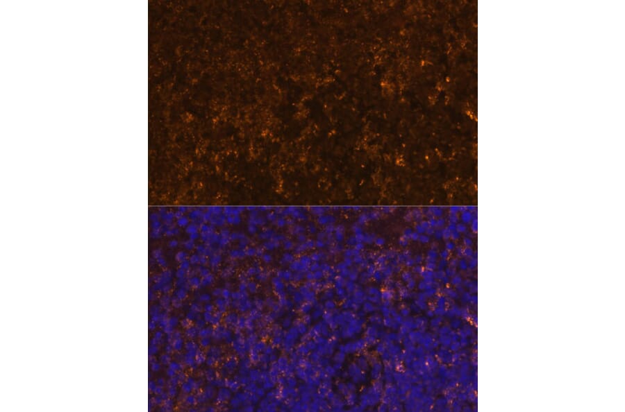 Immunofluorescence - Anti-KLRC4 Antibody (A88311) - Antibodies.com