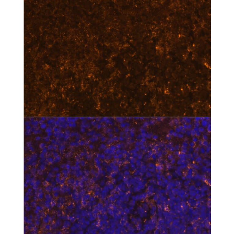 Immunofluorescence - Anti-KLRC4 Antibody (A88311) - Antibodies.com