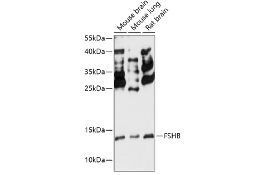 Western Blot - Anti-FSH beta Antibody (A88312) - Antibodies.com