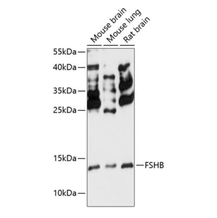 Western Blot - Anti-FSH beta Antibody (A88312) - Antibodies.com