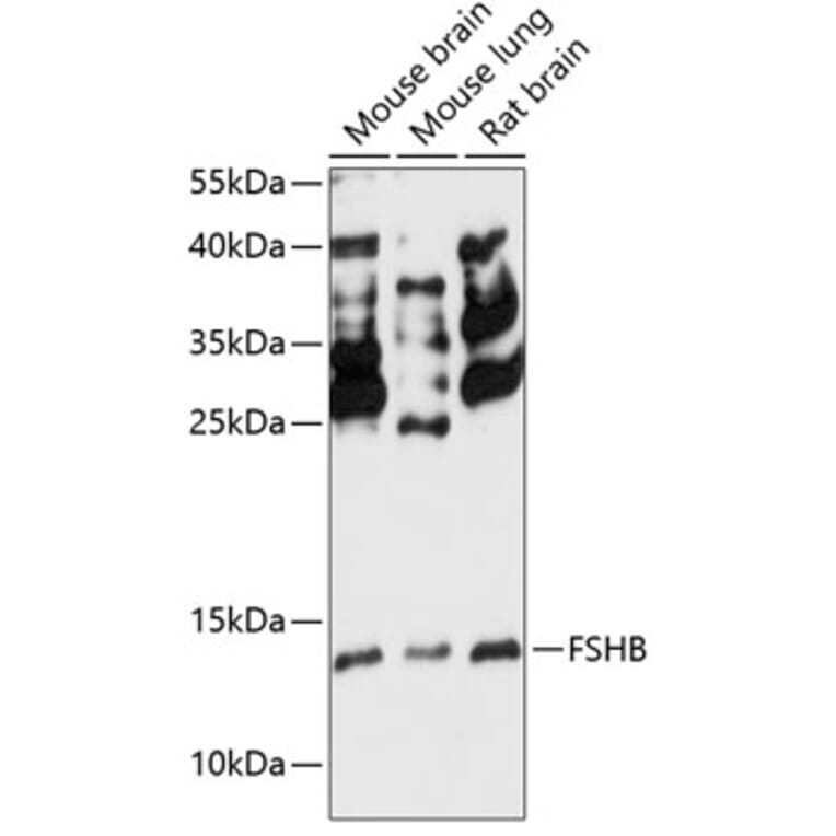 Western Blot - Anti-FSH beta Antibody (A88312) - Antibodies.com