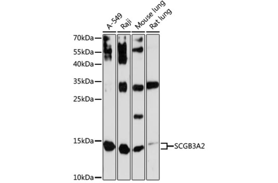 Western Blot - Anti-SCGB3A2 Antibody (A88313) - Antibodies.com