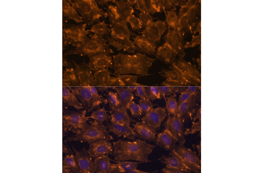 Immunofluorescence - Anti-SCGB3A2 Antibody (A88313) - Antibodies.com