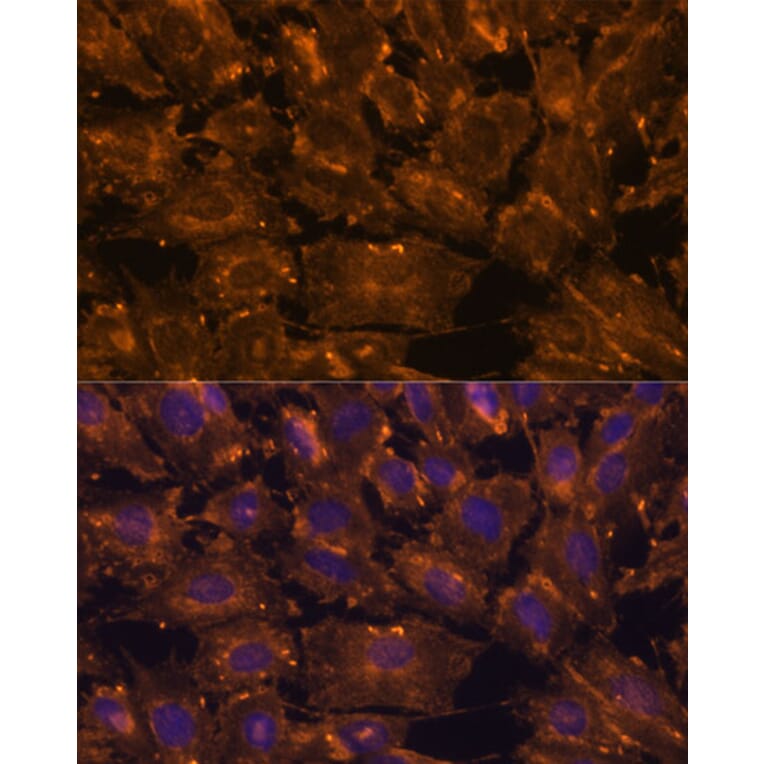 Immunofluorescence - Anti-SCGB3A2 Antibody (A88313) - Antibodies.com