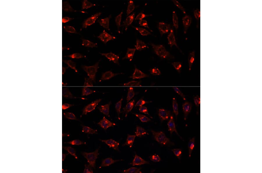 Immunofluorescence - Anti-SCGB3A2 Antibody (A88313) - Antibodies.com