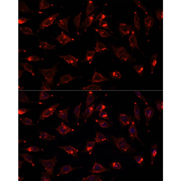 Immunofluorescence - Anti-SCGB3A2 Antibody (A88313) - Antibodies.com