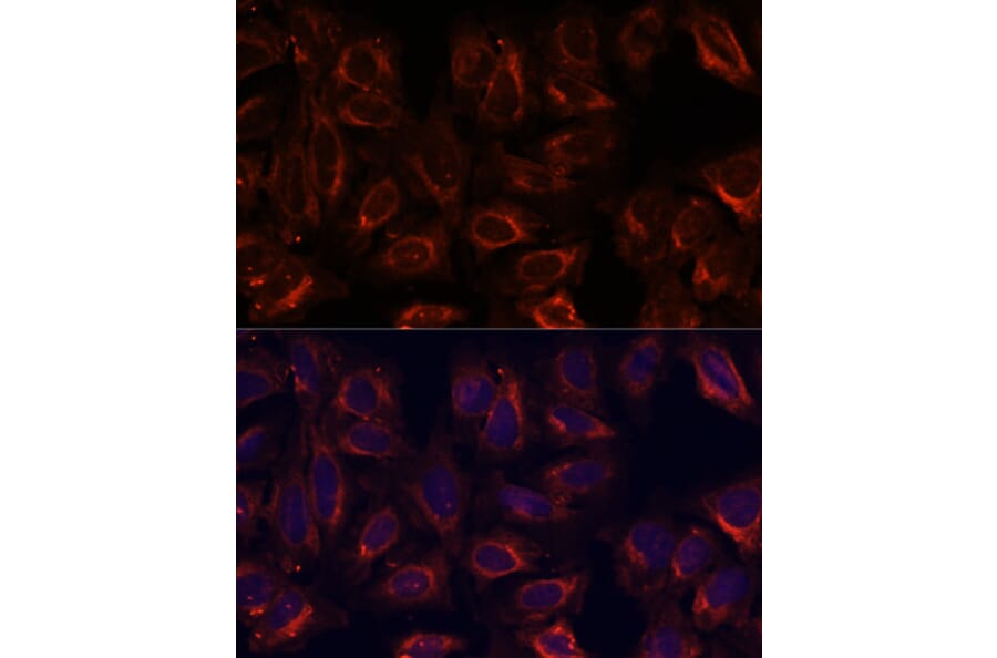 Immunofluorescence - Anti-SCGB3A2 Antibody (A88313) - Antibodies.com