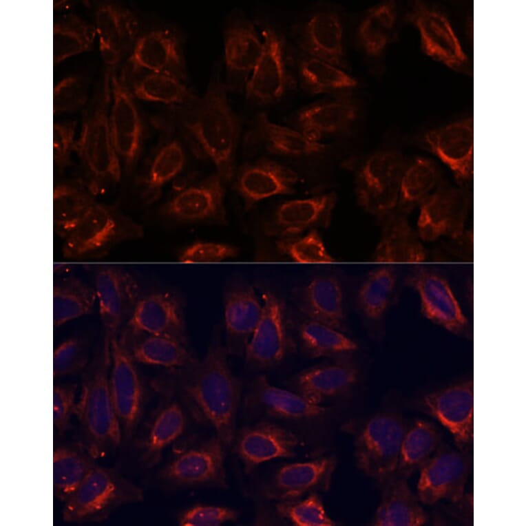 Immunofluorescence - Anti-SCGB3A2 Antibody (A88313) - Antibodies.com