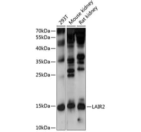 Western Blot - Anti-LAIR2 Antibody (A88314) - Antibodies.com