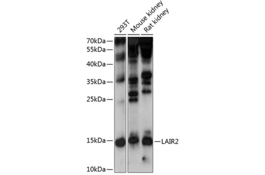 Western Blot - Anti-LAIR2 Antibody (A88314) - Antibodies.com