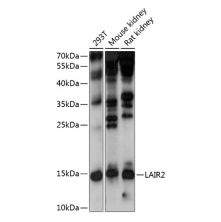 Western Blot - Anti-LAIR2 Antibody (A88314) - Antibodies.com