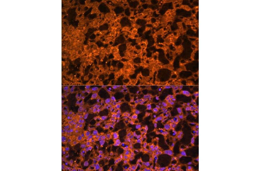 Immunofluorescence - Anti-LAIR2 Antibody (A88314) - Antibodies.com