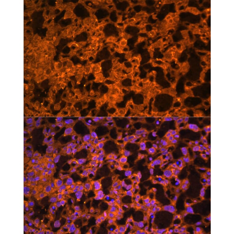 Immunofluorescence - Anti-LAIR2 Antibody (A88314) - Antibodies.com
