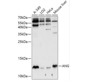 Western Blot - Anti-Angiogenin Antibody (A88315) - Antibodies.com