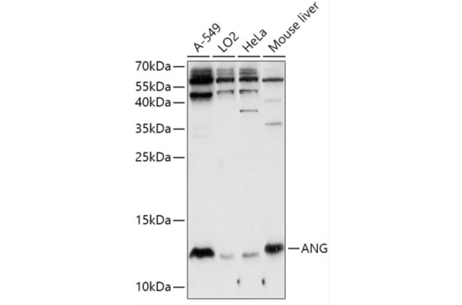 Western Blot - Anti-Angiogenin Antibody (A88315) - Antibodies.com