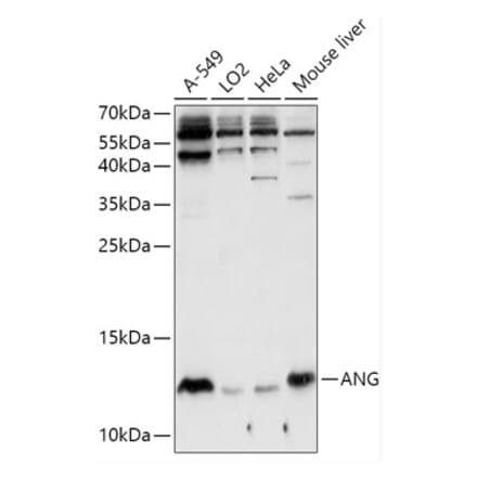 Western Blot - Anti-Angiogenin Antibody (A88315) - Antibodies.com