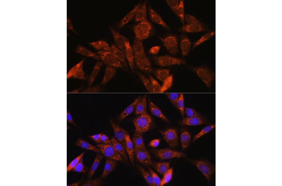 Immunofluorescence - Anti-Angiogenin Antibody (A88315) - Antibodies.com