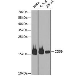 Western Blot - Anti-CD59 Antibody (A88316) - Antibodies.com