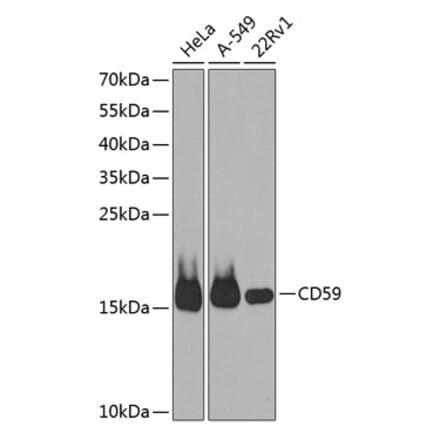 Western Blot - Anti-CD59 Antibody (A88316) - Antibodies.com