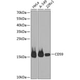 Western Blot - Anti-CD59 Antibody (A88316) - Antibodies.com