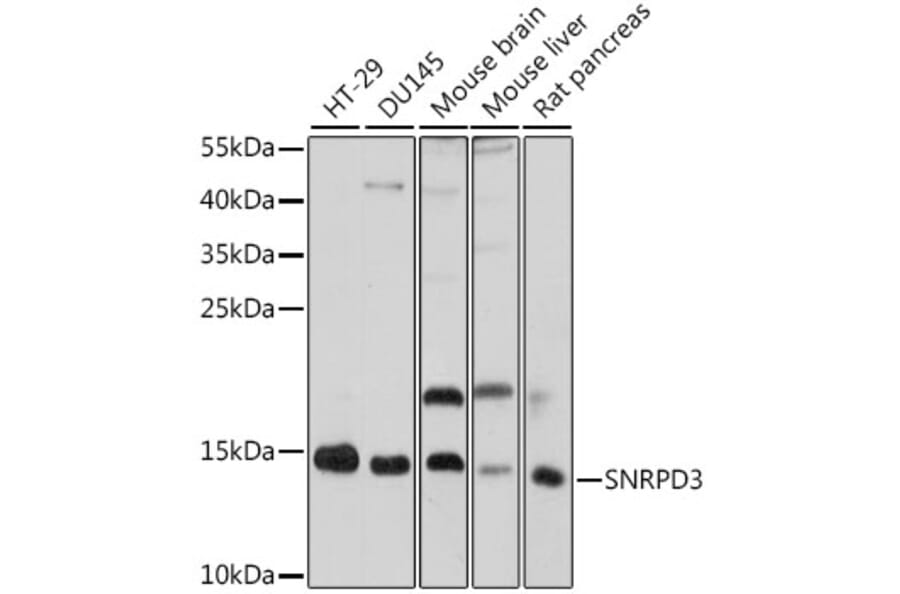 Western Blot - Anti-SNRPD3/Sm-D3 Antibody (A88318) - Antibodies.com