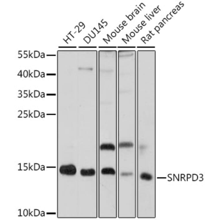 Western Blot - Anti-SNRPD3/Sm-D3 Antibody (A88318) - Antibodies.com