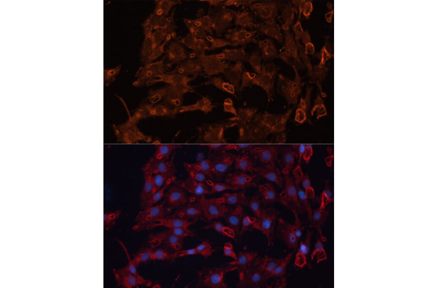 Immunofluorescence - Anti-ABCB11/BSEP Antibody (A88319) - Antibodies.com