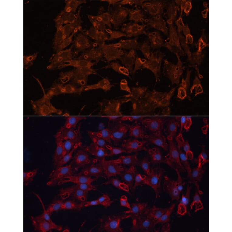Immunofluorescence - Anti-ABCB11/BSEP Antibody (A88319) - Antibodies.com