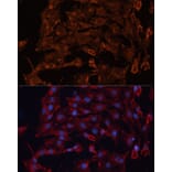 Immunofluorescence - Anti-ABCB11/BSEP Antibody (A88319) - Antibodies.com