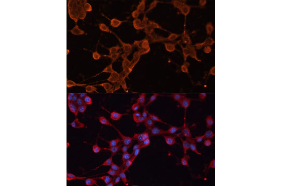 Immunofluorescence - Anti-ABCB11/BSEP Antibody (A88319) - Antibodies.com