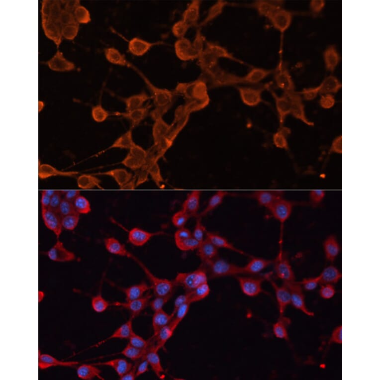 Immunofluorescence - Anti-ABCB11/BSEP Antibody (A88319) - Antibodies.com