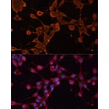 Immunofluorescence - Anti-ABCB11/BSEP Antibody (A88319) - Antibodies.com