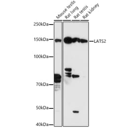 Western Blot - Anti-LATS2 Antibody (A88320) - Antibodies.com