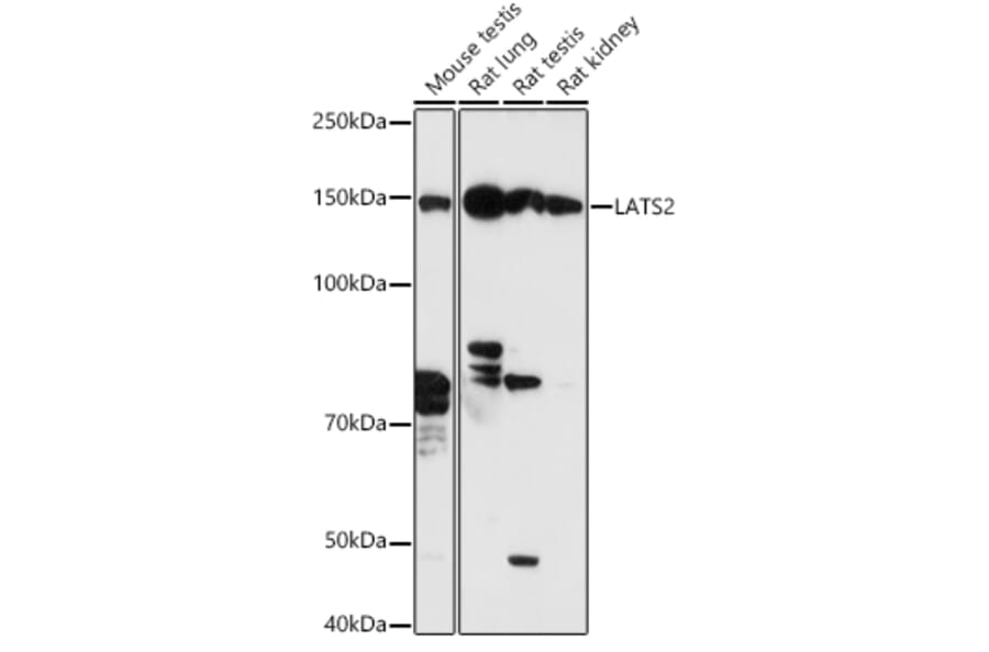 Western Blot - Anti-LATS2 Antibody (A88320) - Antibodies.com