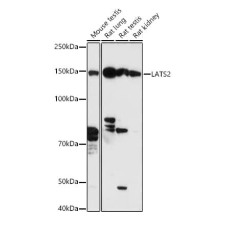 Western Blot - Anti-LATS2 Antibody (A88320) - Antibodies.com