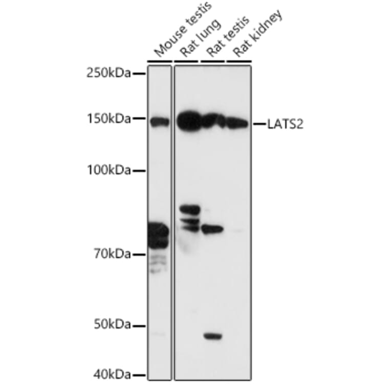 Western Blot - Anti-LATS2 Antibody (A88320) - Antibodies.com