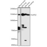 Western Blot - Anti-LATS2 Antibody (A88320) - Antibodies.com